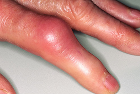 ʹ����ֻ�����Щ֢״