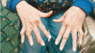 ���ʪ�����ճ�Ҫע�ر���