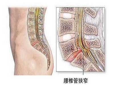 ׵����խ��ԭ�����